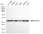 KD-Validated Anti-SNRPA1 Rabbit Monoclonal Antibody